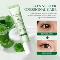 Centella Asiatica Eye Cream,Moisturizes and Tightens the Skin Around the Eyes…